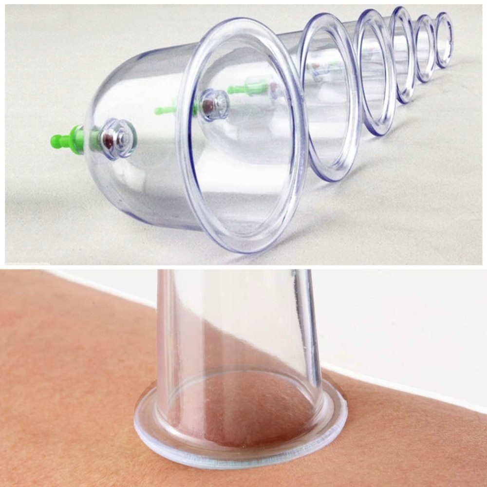 Chinese Great Medical Body Healthy Care 12Cups Kit Cupping Therapy Cups Hot Selling - Unique